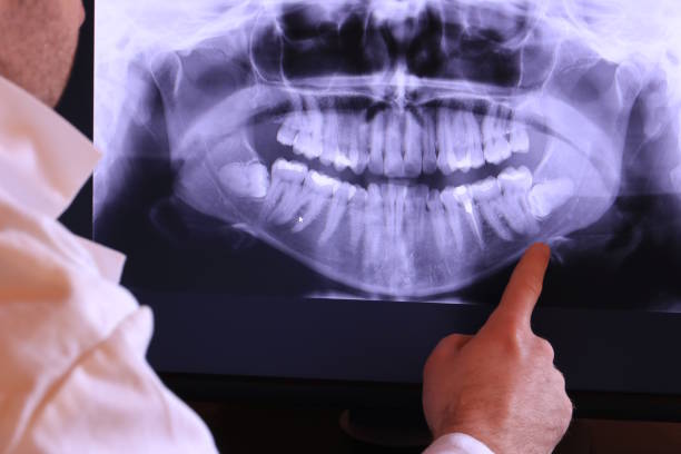 Best Pediatric Emergency Dentist in Michigan City, IN